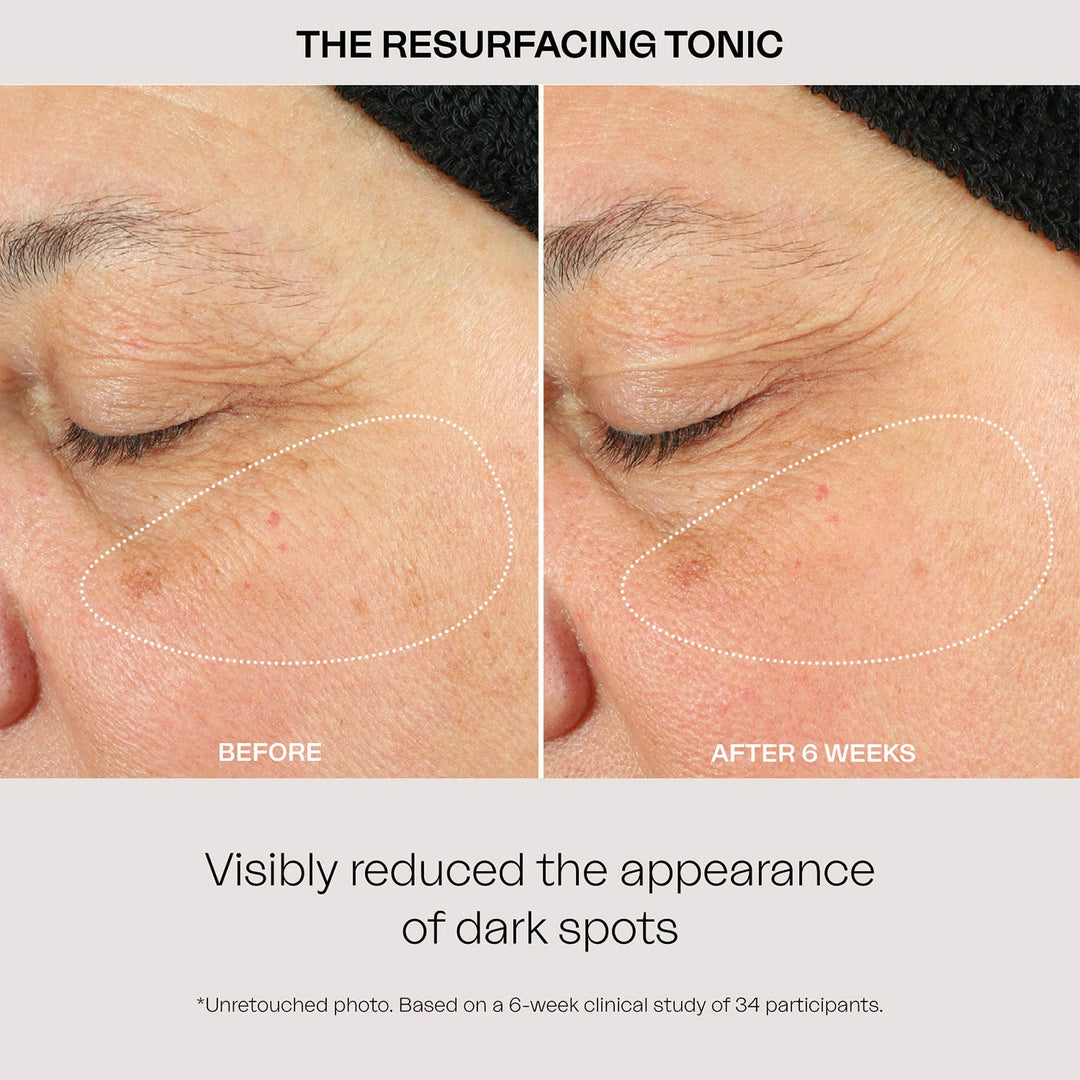 The Resurfacing Tonic 100 Ml