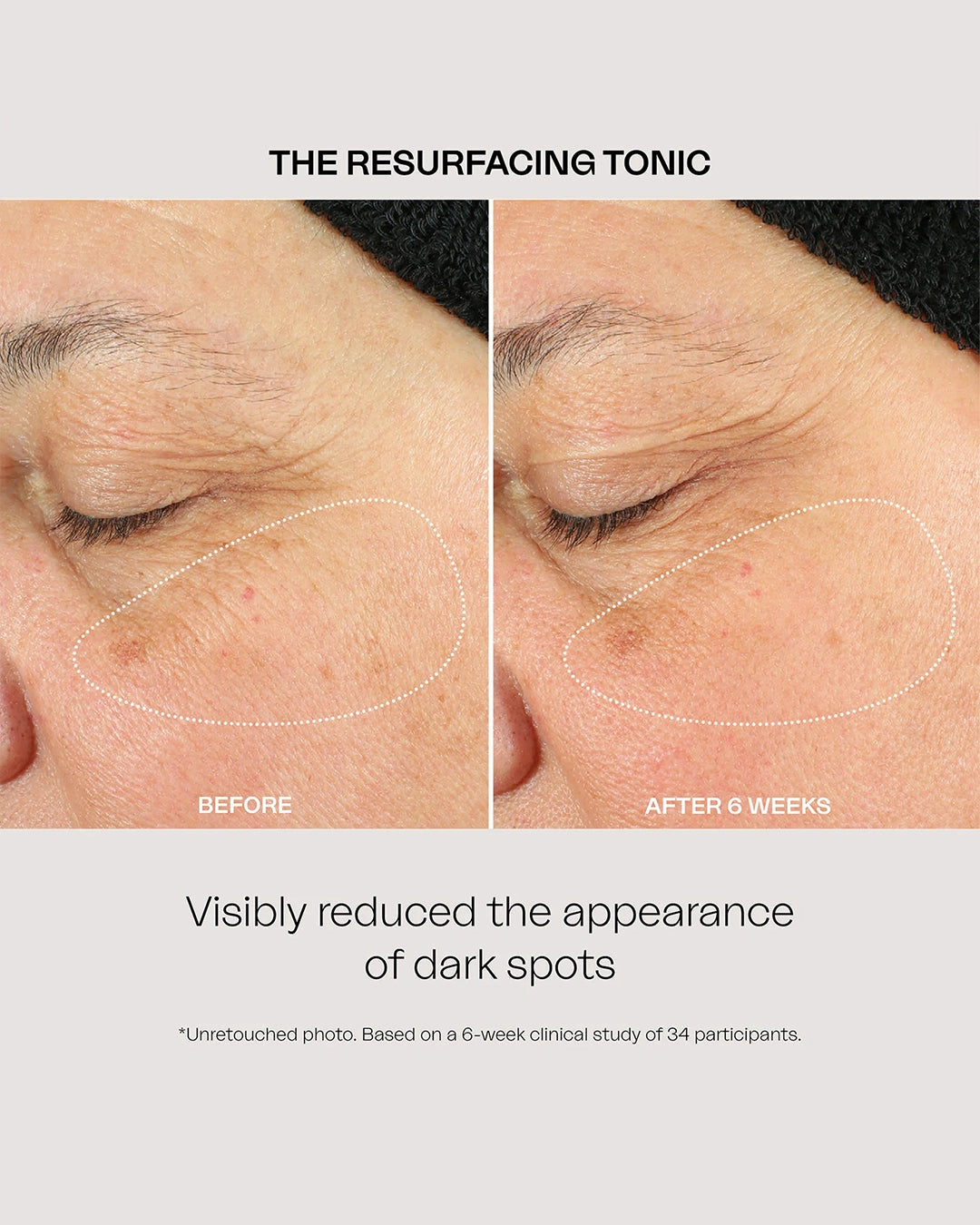 The Resurfacing Tonic 100 Ml
