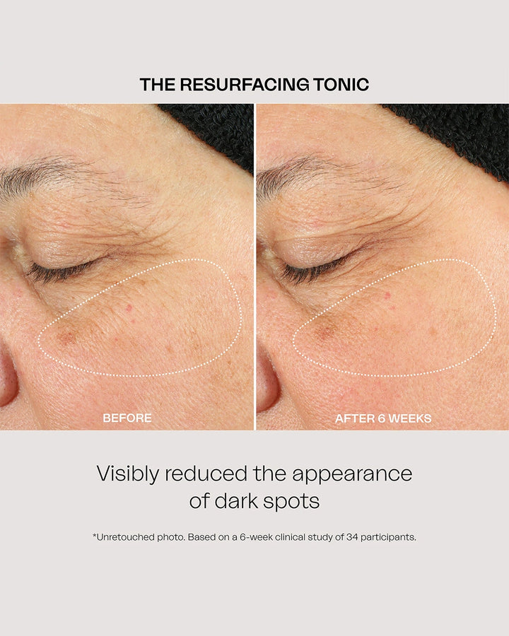 The Resurfacing Tonic 100 Ml