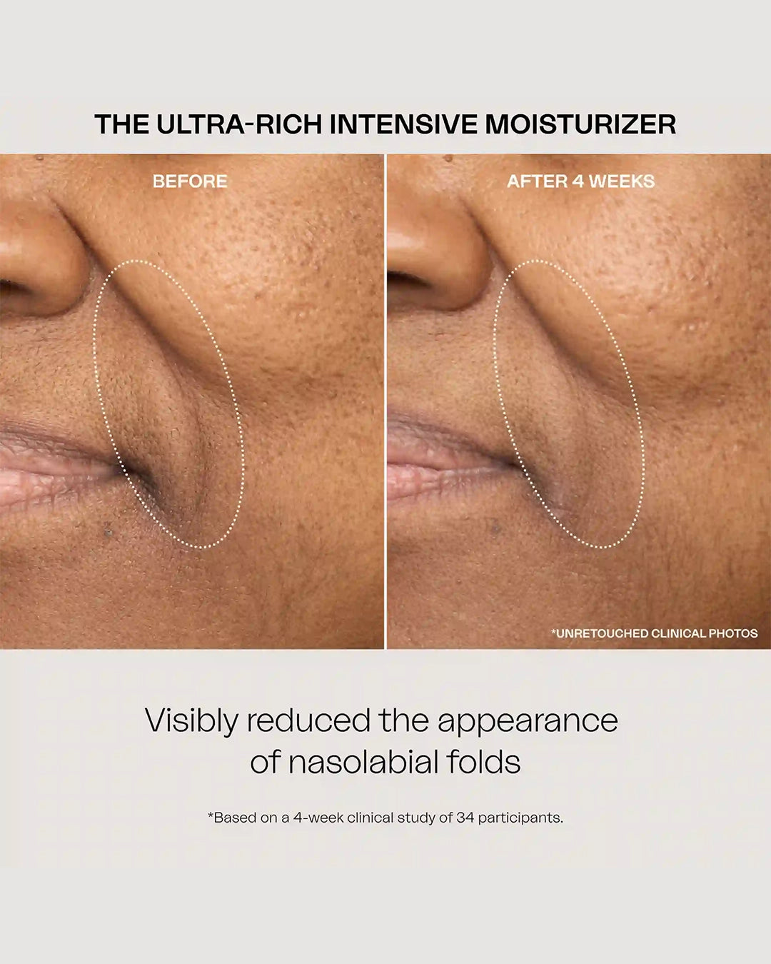 The Ultra Rich Intensive Moisturizer 50 Ml