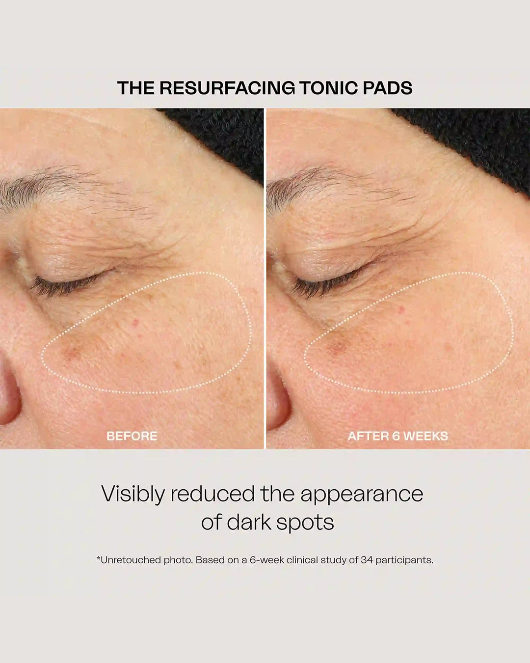 The Resurfacing Tonic Pads