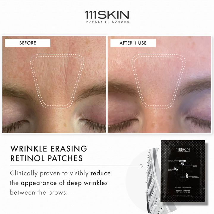 Wrinkle Erasing Retinol Patches